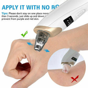 5 in 1 Rechargeable Blackhead Remover